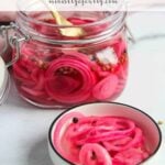 Pinterest pin for pickled onions photo.